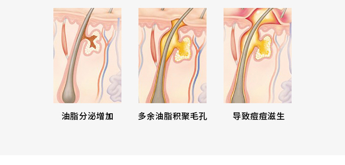 朵旎祛痘修護(hù)原液 朵旎祛痘修護(hù)原液